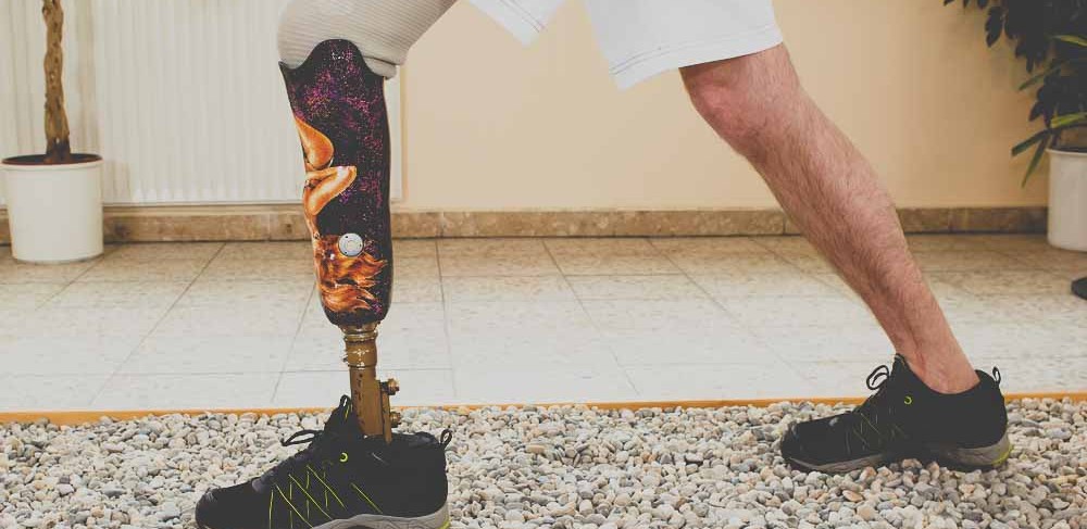 Bicycle Accident Attorney