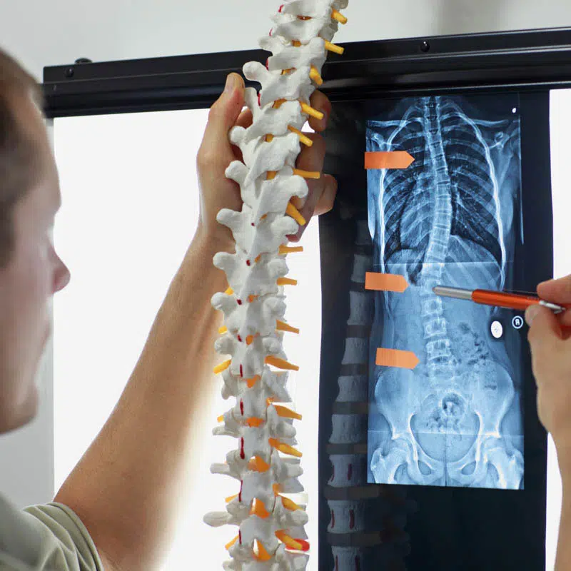 Motorcycle Accident Attorney